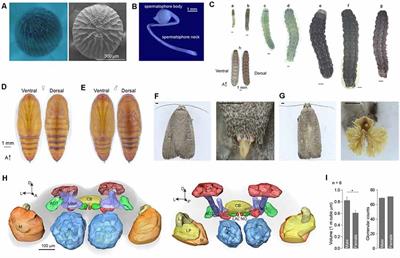 Antennal Lobe Atlas of an Emerging Corn Pest, Athetis dissimilis